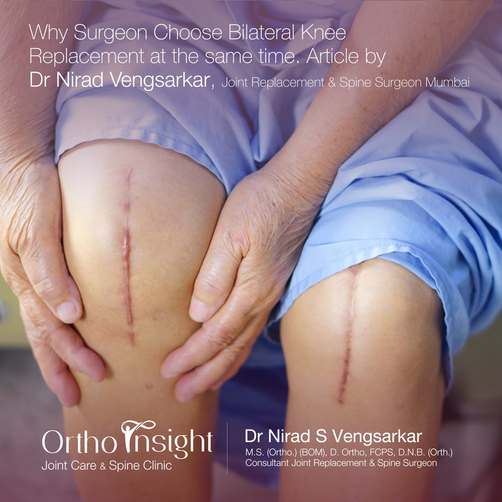 Why Surgeon Choose Bilateral Knee Replacement at the same time